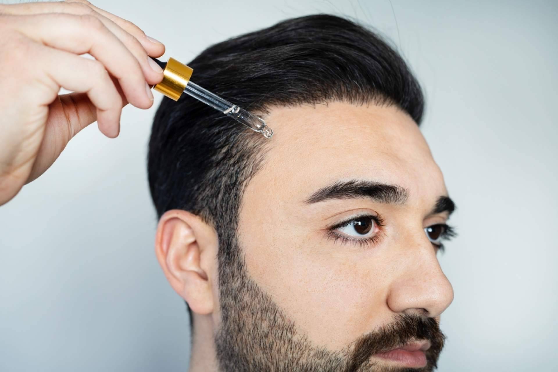¿Cuáles son los beneficios de realizarse un peeling capilar?, con Malecare