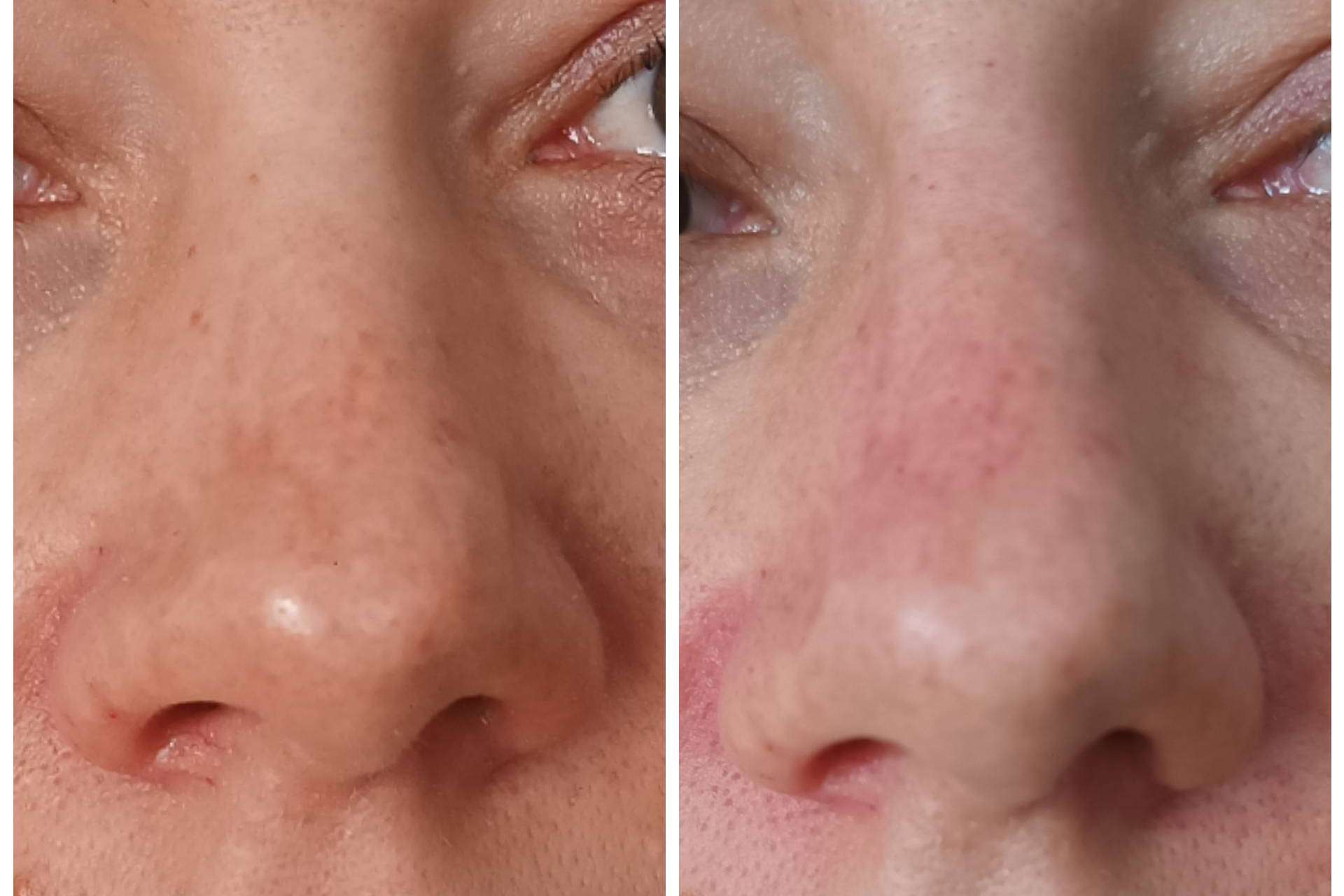 Medicina estética facial y dental para una sonrisa perfecta, con Clínica Calvo de Mora