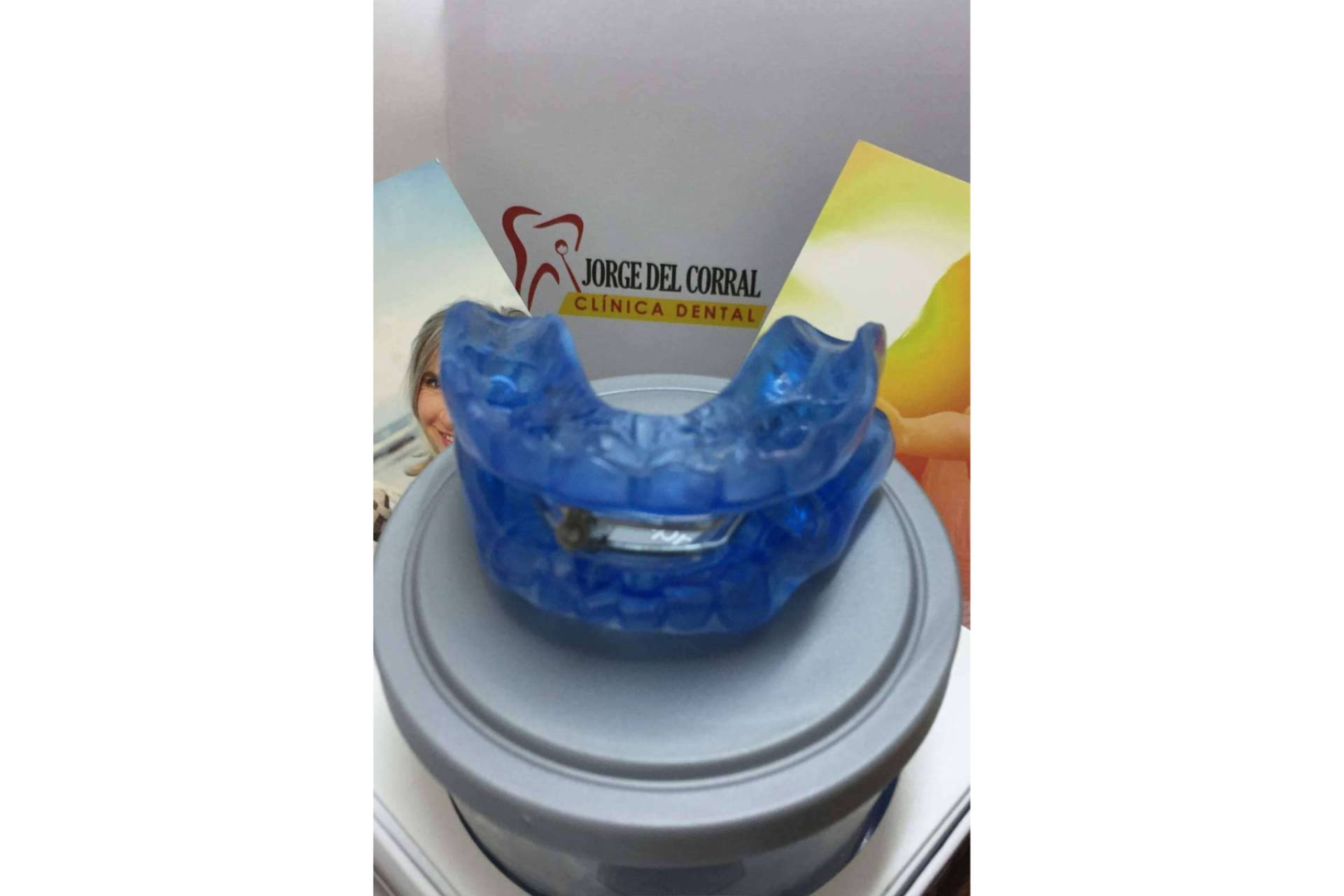El dispositivo de avance mandibular, la solución para la apnea del sueño y los ronquidos, disponible en Hortaleza