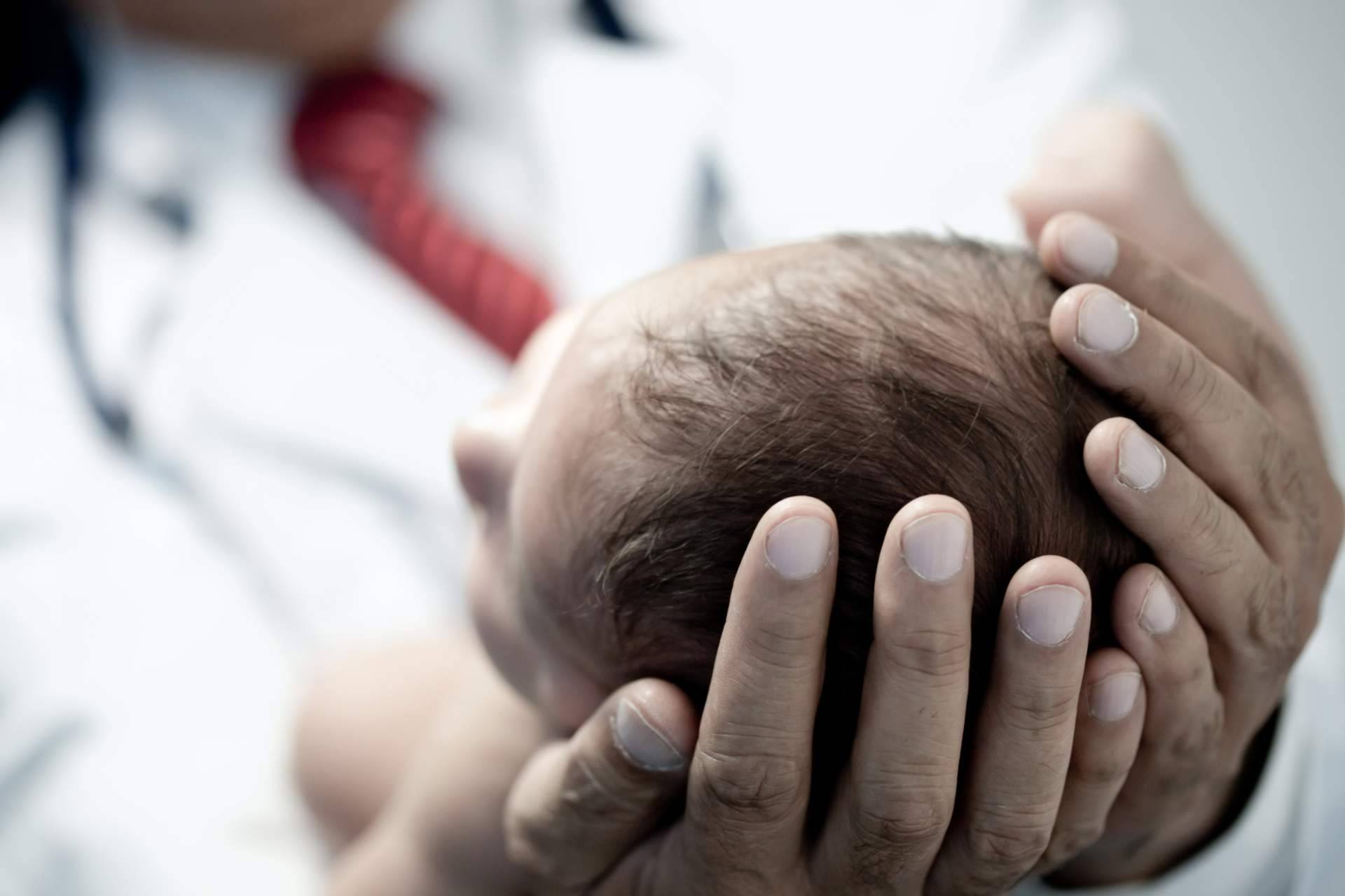 Hidrocele infantil y hernias inguinales, cuándo es necesaria la cirugía en bebés y niños
