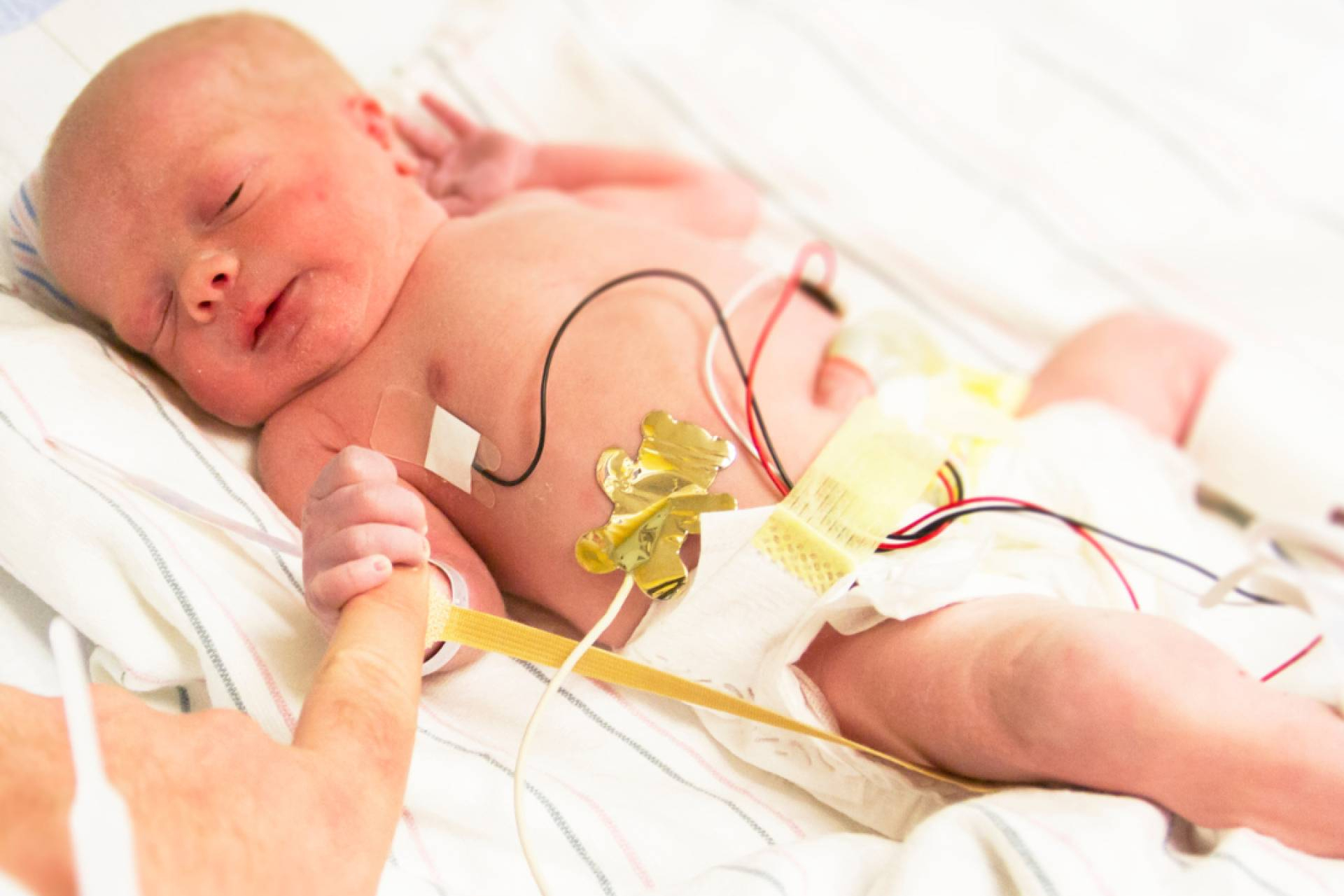 El viaje invisible de los bebés prematuros y sus familias, apoyado por Pequeños Grandes Héroes